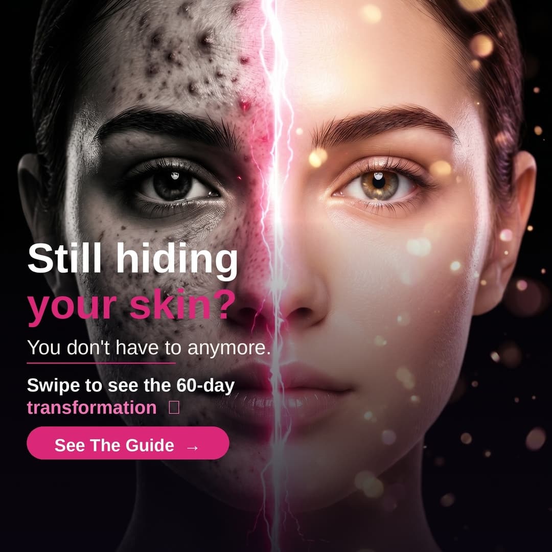 60 day acne transformation before and after